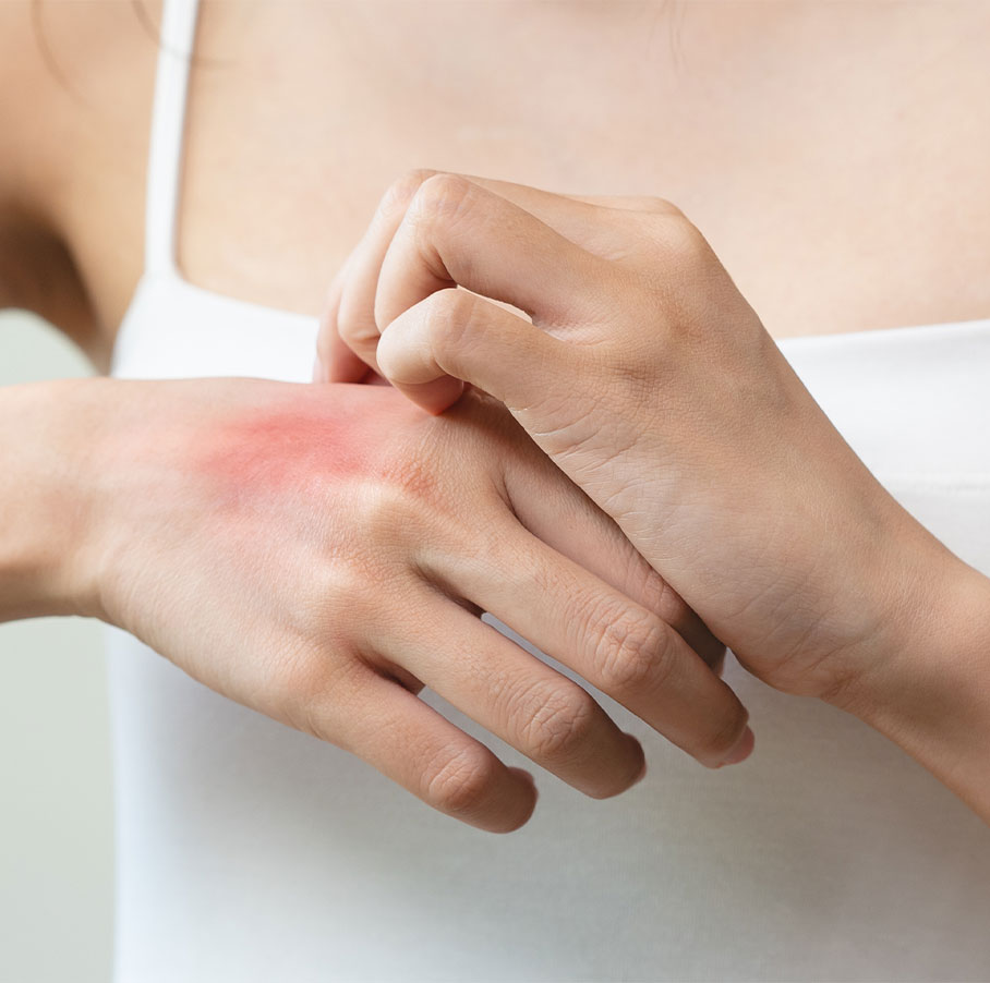 insectenbeet verlichten met azijn