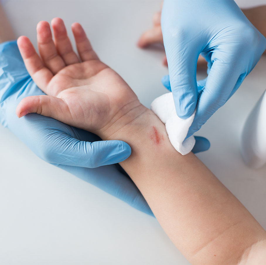 schaafwondjes ontsmetten met azijn